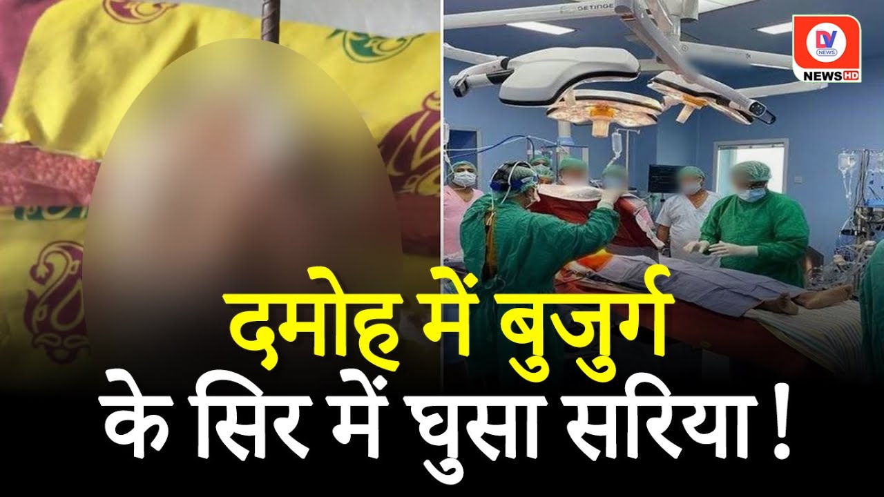 Jabalpur News: बुजुर्ग के सिर में घुसी लोहे की Rod! Doctors ने किया सफल operation