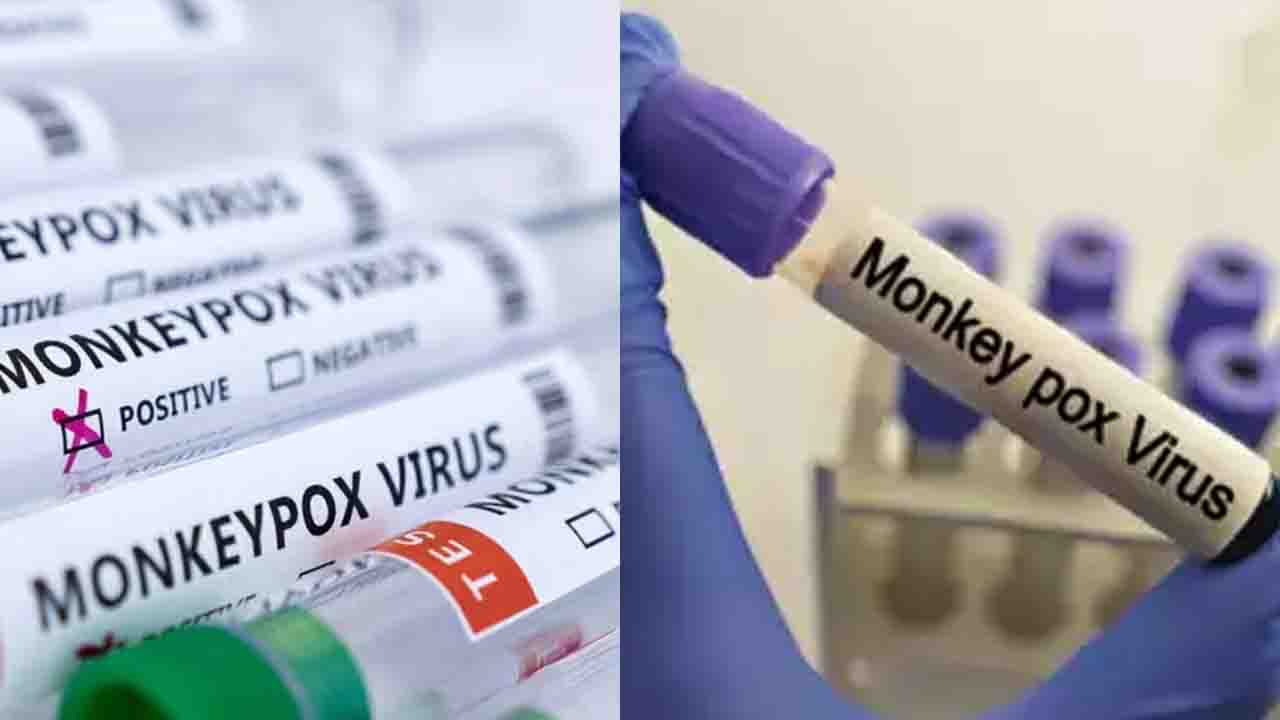 Monkeypox Virus ने दी भारत में दस्तक, सभी राज्यों को जारी की एडवाइजरी